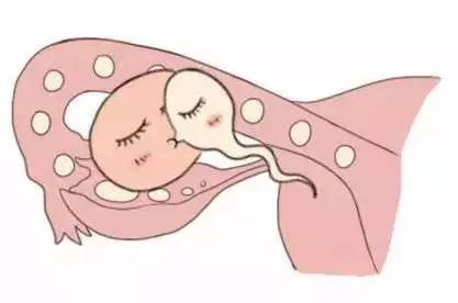 试管包生男孩医院试管婴儿中心
